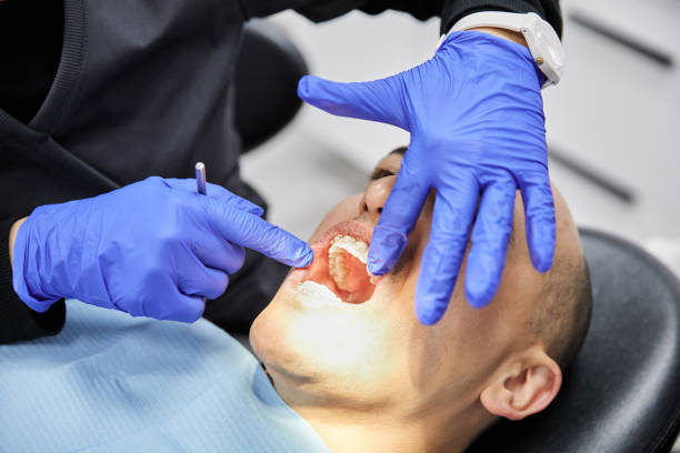 Best Emergency Treatment for Toothache in Dalton, GA